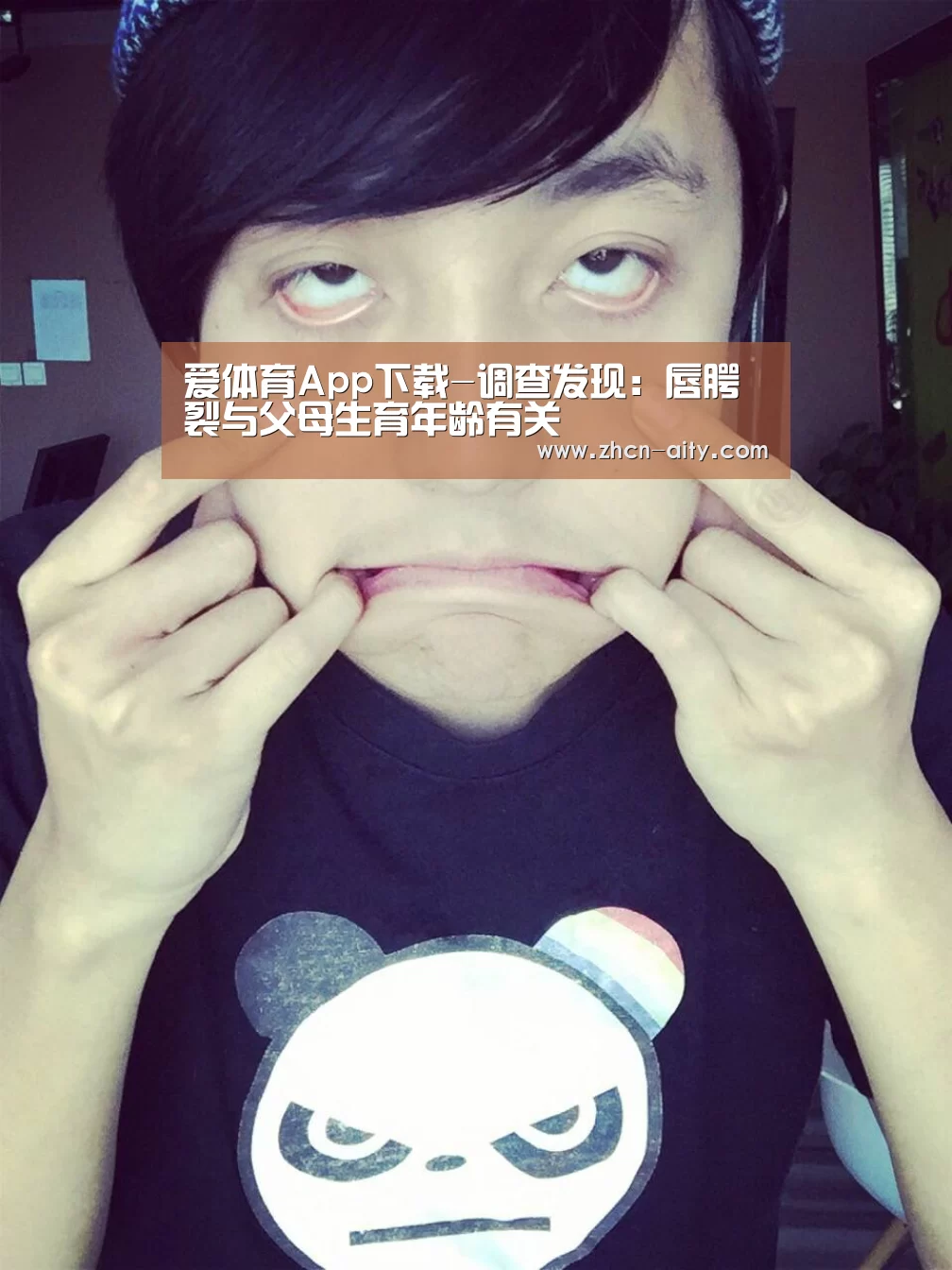 爱体育App下载-调查发现:唇腭裂与父母生育年龄有关(图1) 爱体育App下载